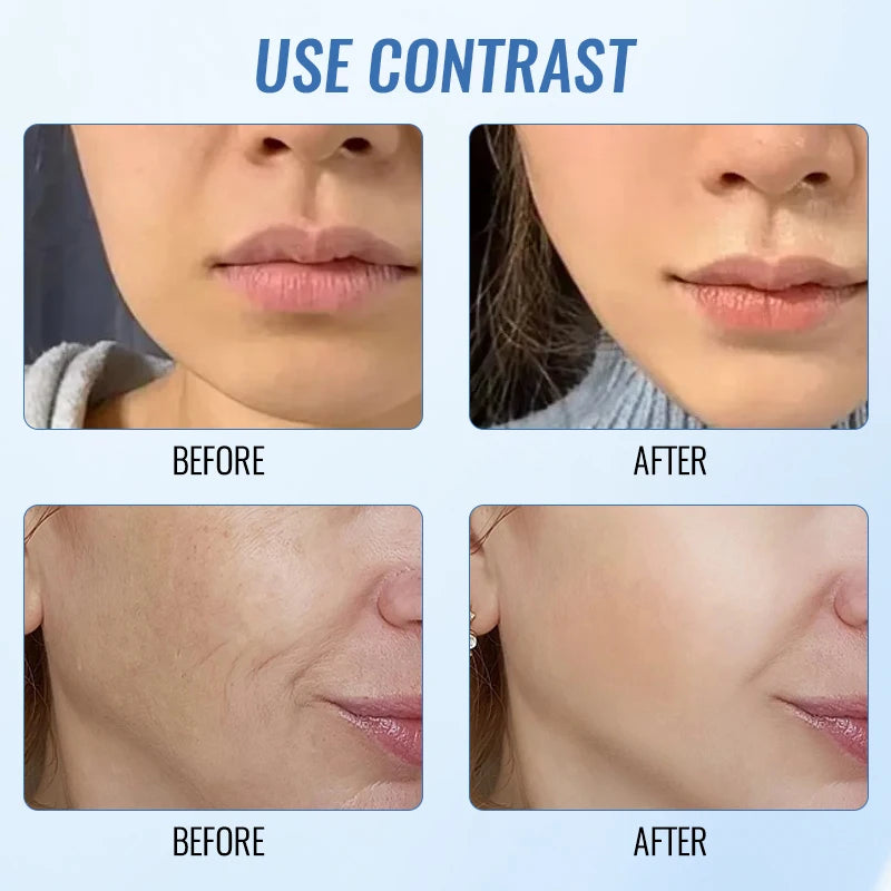NEWEST 7 in 1 Face Lifting Device EMS Microcurrent Skin Rejuvenation LED Facial Neck
