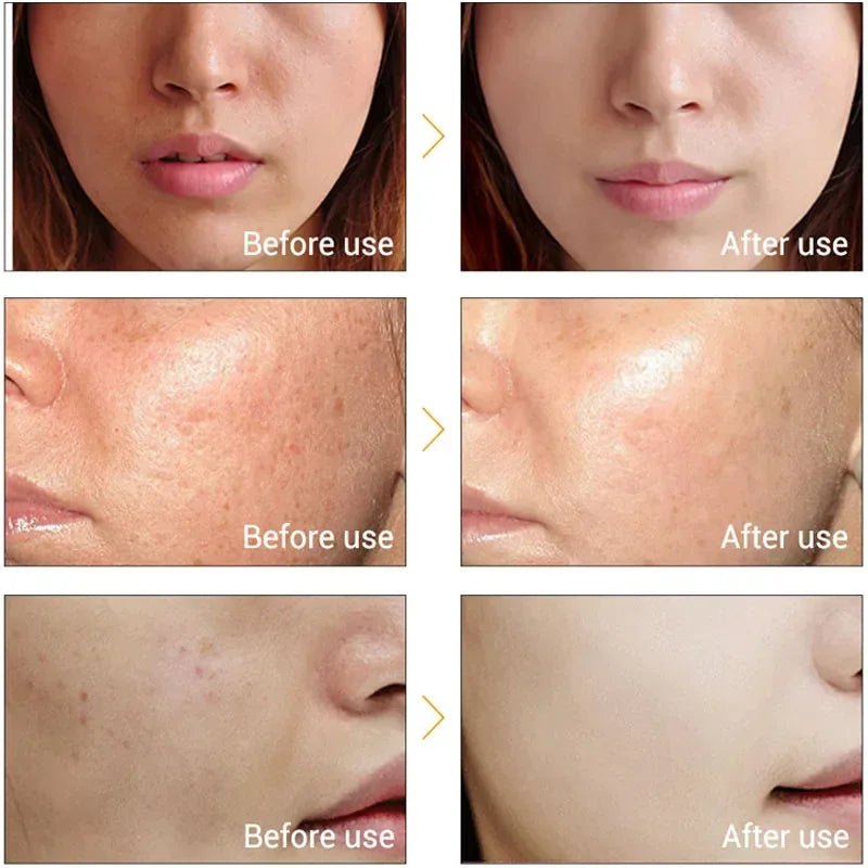 Electric Facial Beauty Device Ultrasonic Ionic Face Cleaner Anti-aging Machine High Frequency