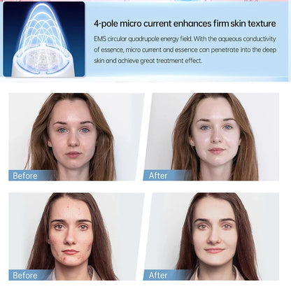 Microcurrent Facial Massage Device Hydra Pen H5 Wireless Automatic Applicator Skin Care