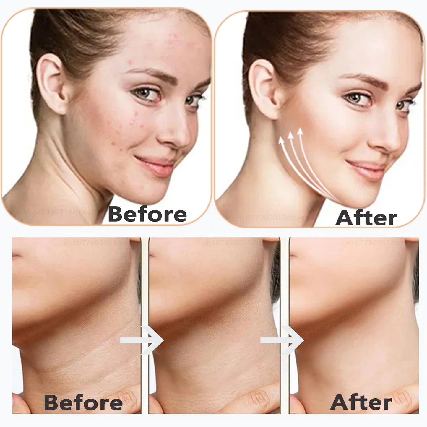 Neck Face Beauty Device EMS Micro-current 7 Color Facial Massager Reduce Double Chin Skin