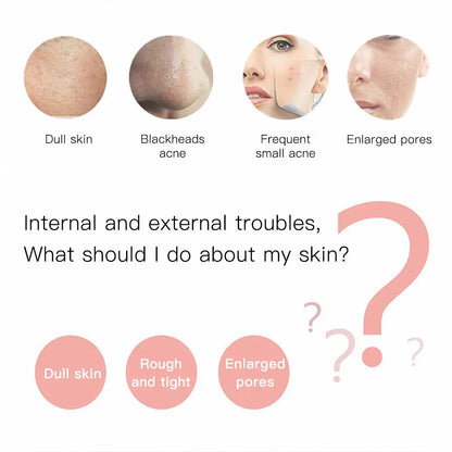 Electric Skin Scrubber Blackhead Remover Dead Skin Acne Scalper Vibration Facial Clean